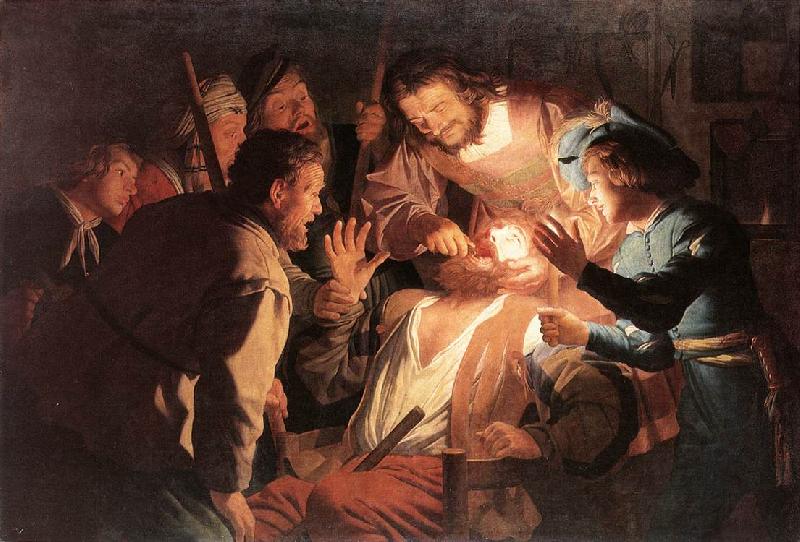 HONTHORST, Gerrit van The Dentist sg oil painting image